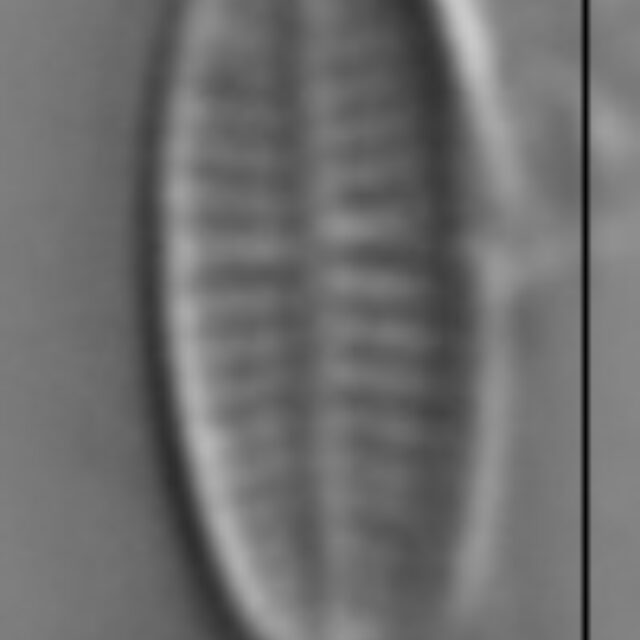 Achnanthidium minutissimum LM5