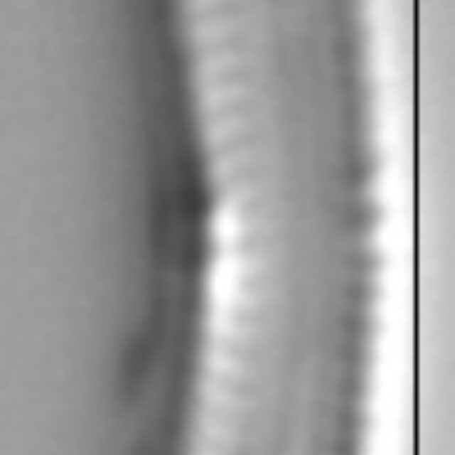 Achnanthidium minutissimum LM7