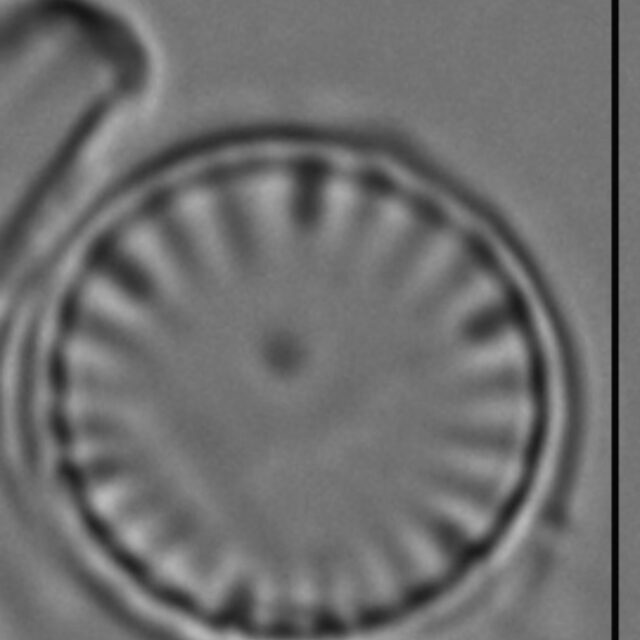 Cyclotella atomus LM1