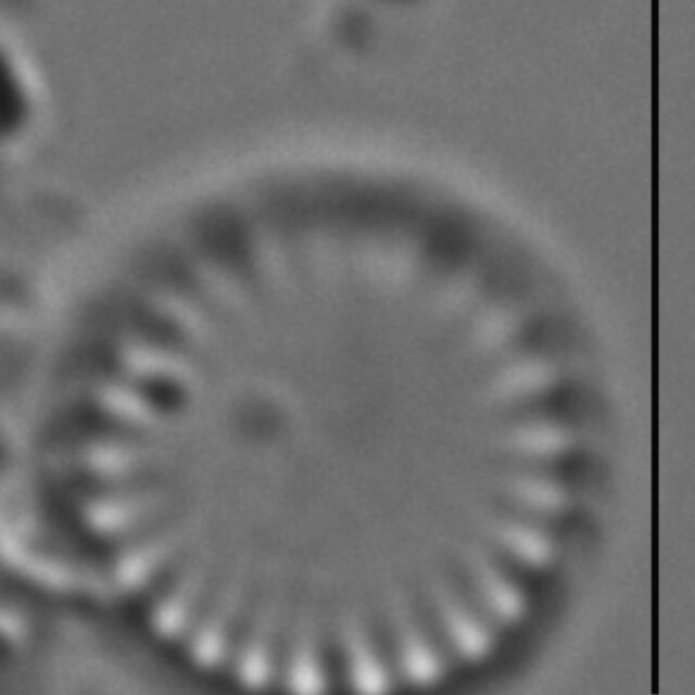 Cyclotella atomus LM5