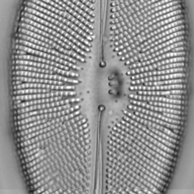 Didymosphenia geminata LM2