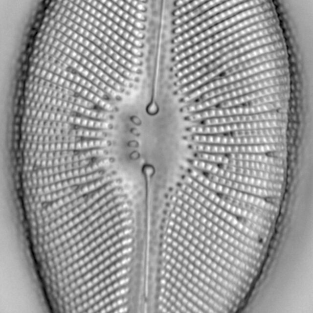 Didymosphenia geminata LM5