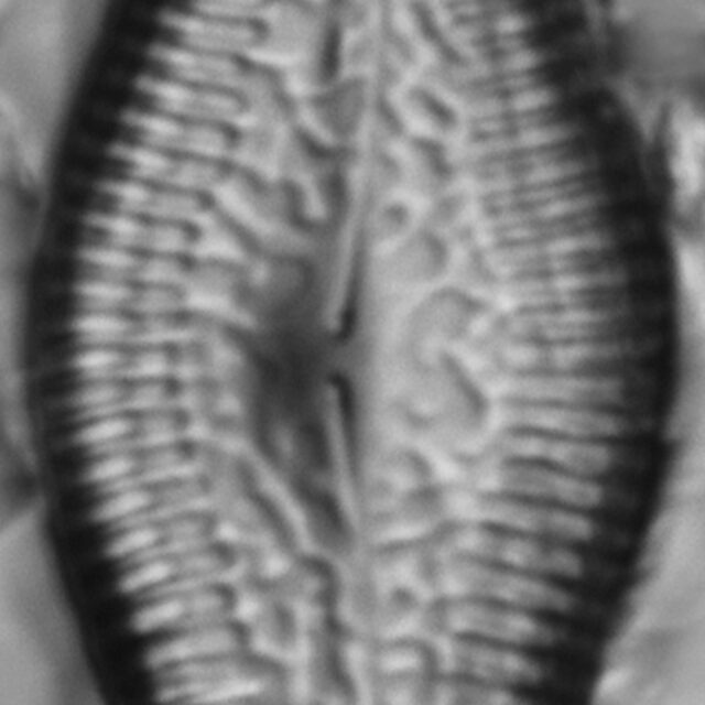 Pinnularia turgidula LM2