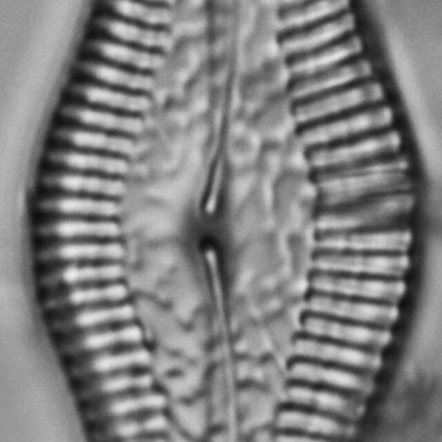 Pinnularia turgidula LM4