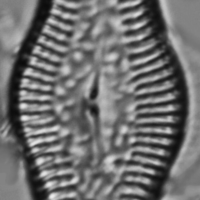 Pinnularia turgidula LM5