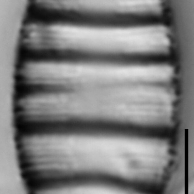 Odontidium hyemale LM2