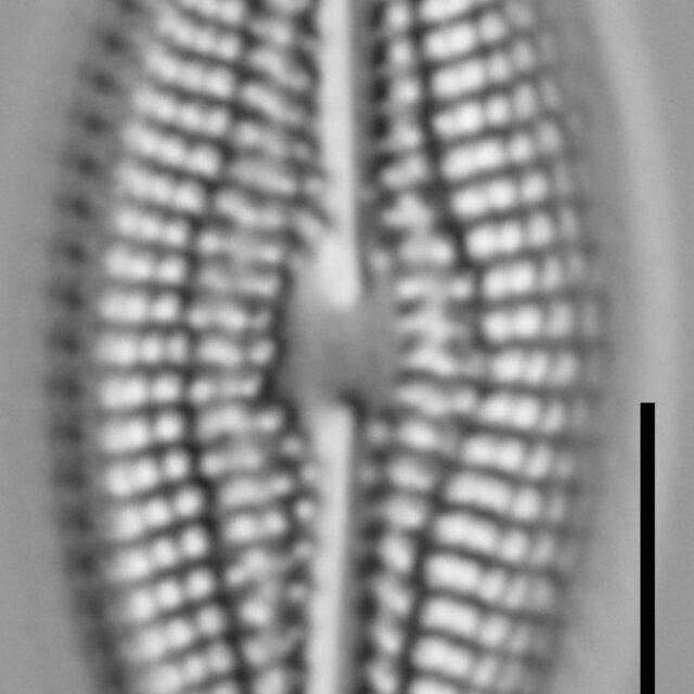 Diploneis abscondita LM5