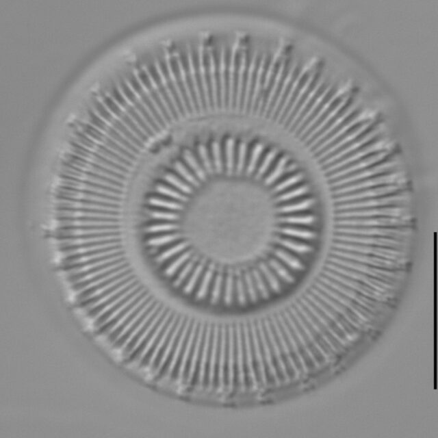 Discostella asterocostata LM3