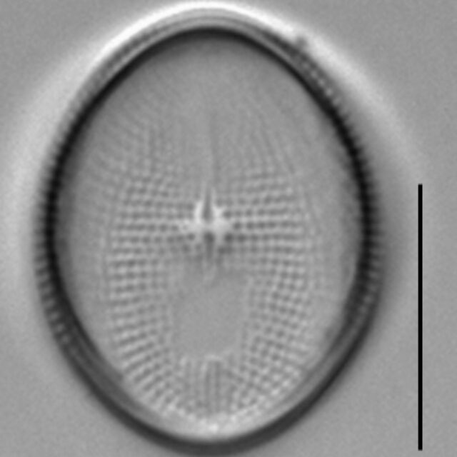 Cocconeis pediculus LM1