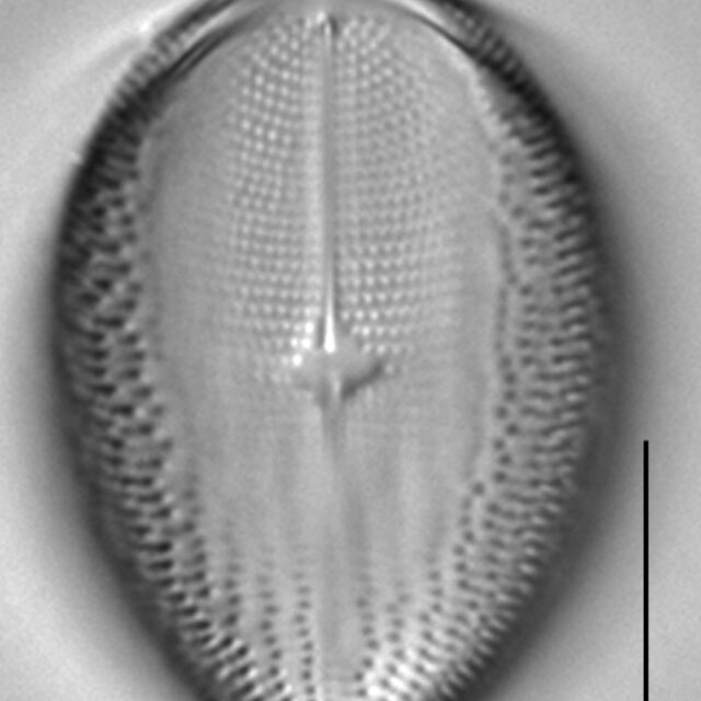 Cocconeis pediculus LM3