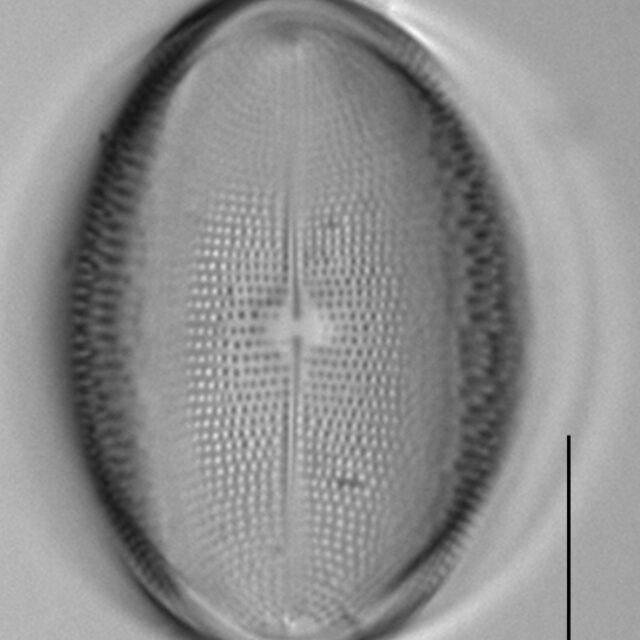 Cocconeis pediculus LM6