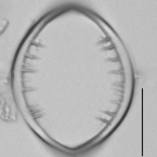 Cocconeis pediculus LM7