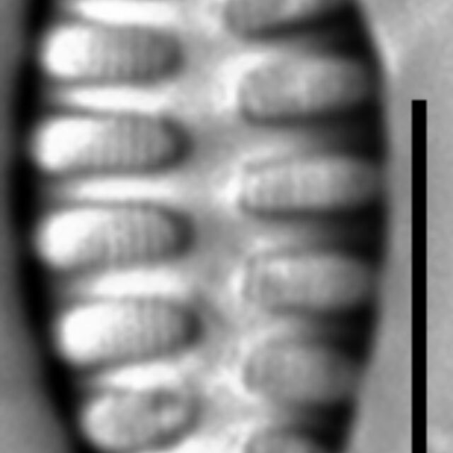 Staurosirella martyi LM11