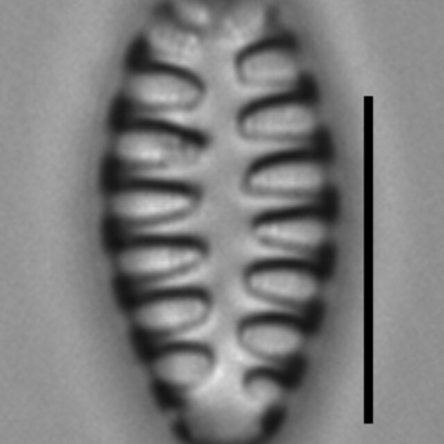 Staurosirella martyi LM8