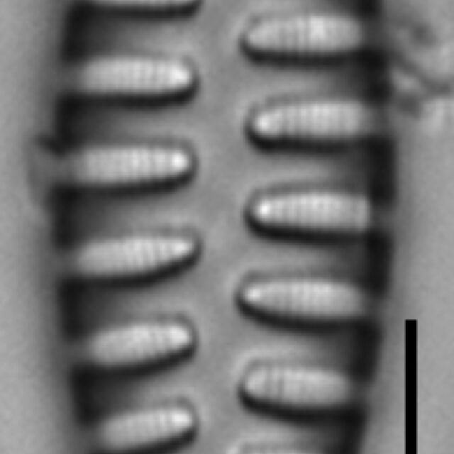 Staurosirella martyi LM5