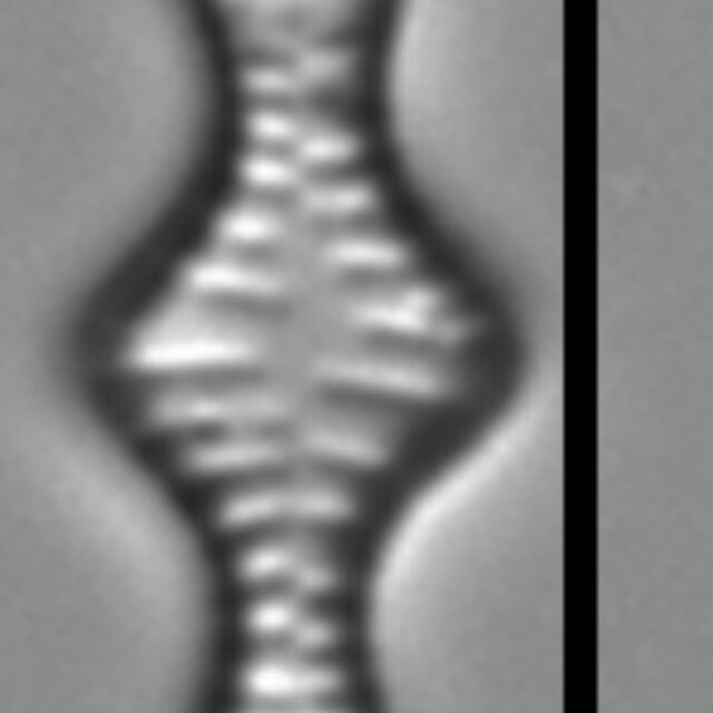 Tabellaria flocculosa LM6