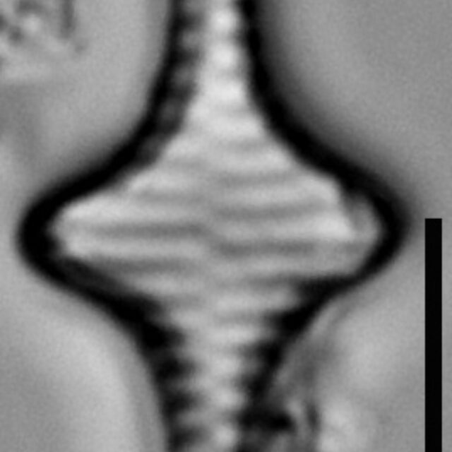 Staurosira stevensonii LM3