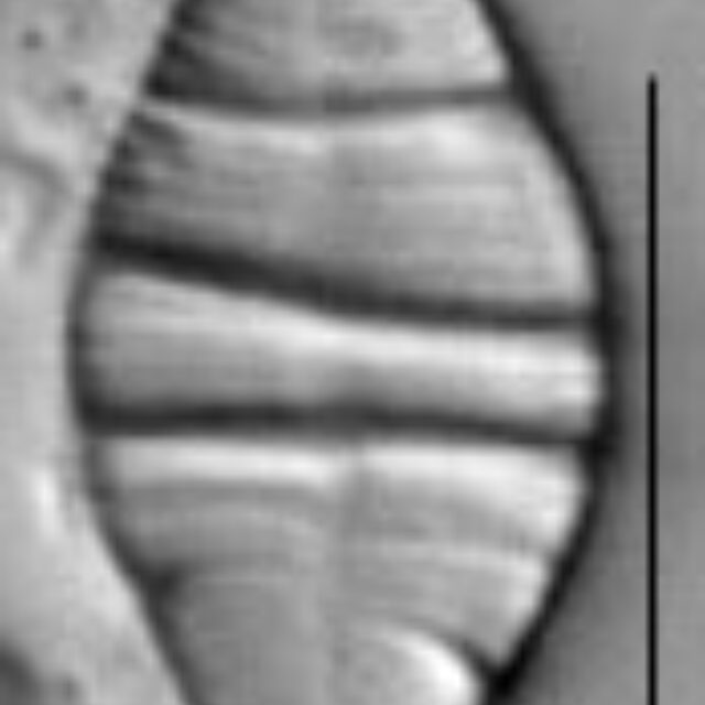 Odontidium mesodon LM1