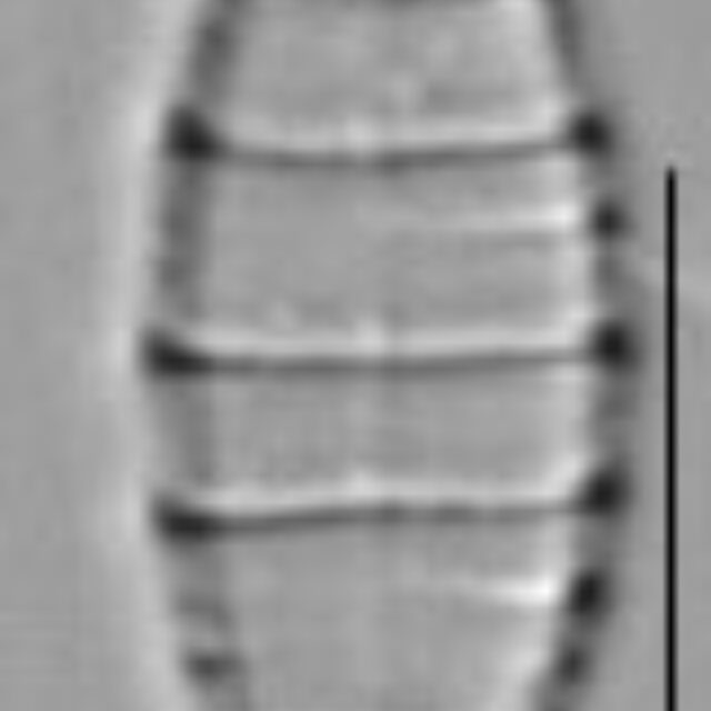 Diatoma moniliformis LM2