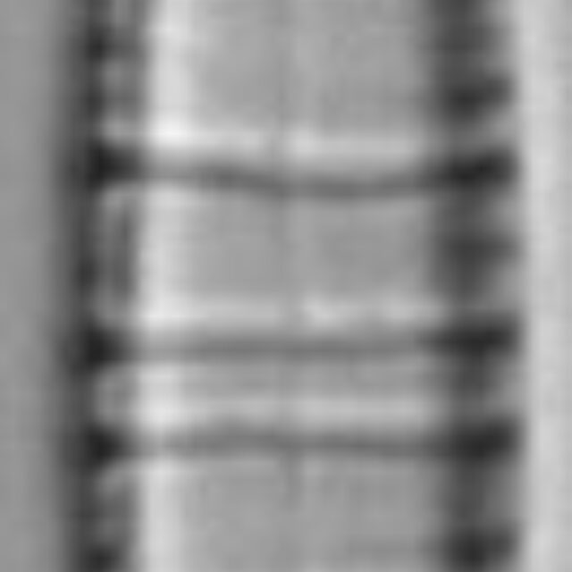 Diatoma moniliformis LM4