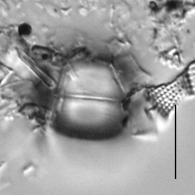 Melosira dickiei LM4