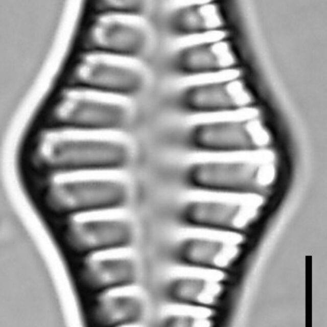 Staurosirella rhomboides LM1