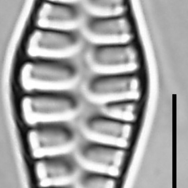 Staurosirella rhomboides LM2