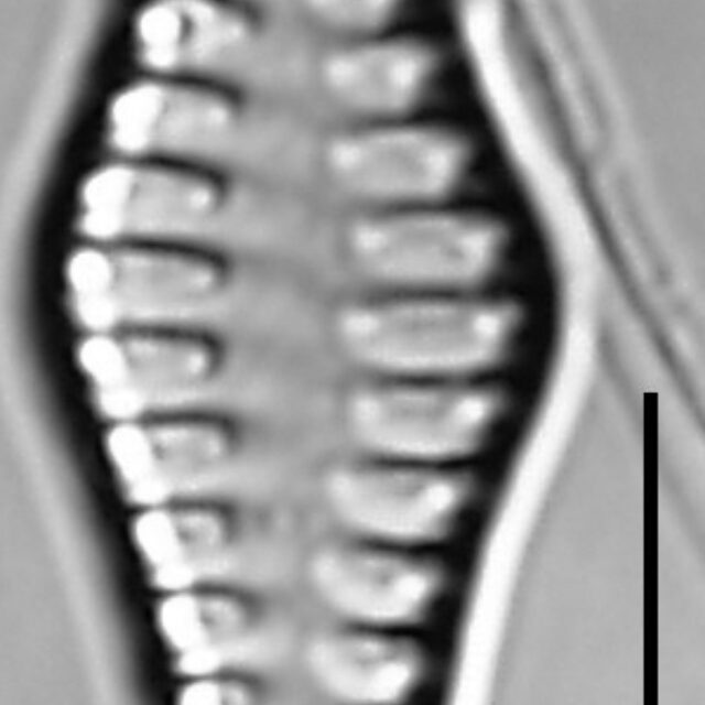 Staurosirella rhomboides LM3