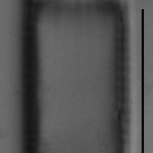 Aulacoseira subarctica LM7