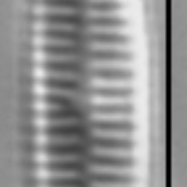 Achnanthidium atomus LM1