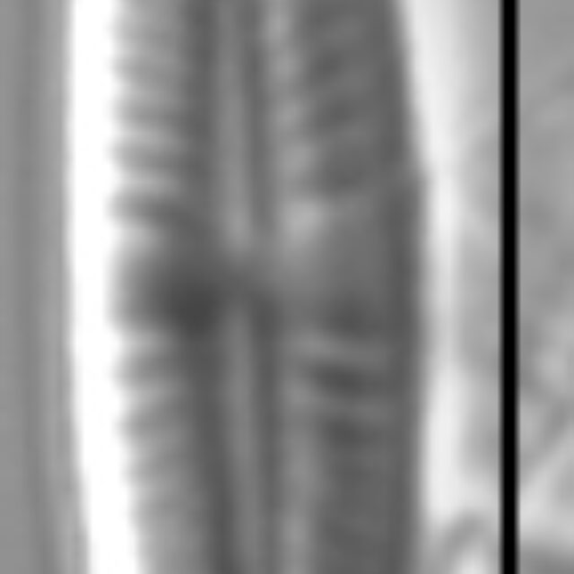 Achnanthidium atomus LM2