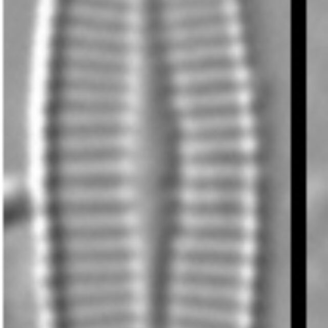 Achnanthidium crassum LM6