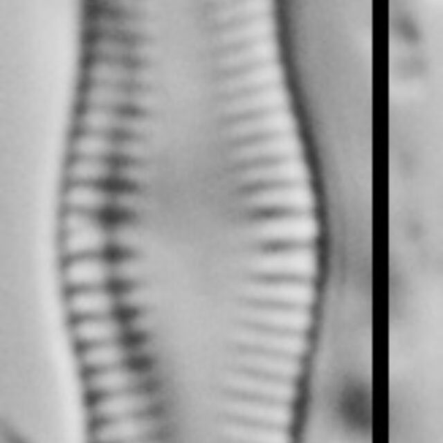 Achnanthidium Rosenstockii Vt10018 A 112117 72 C