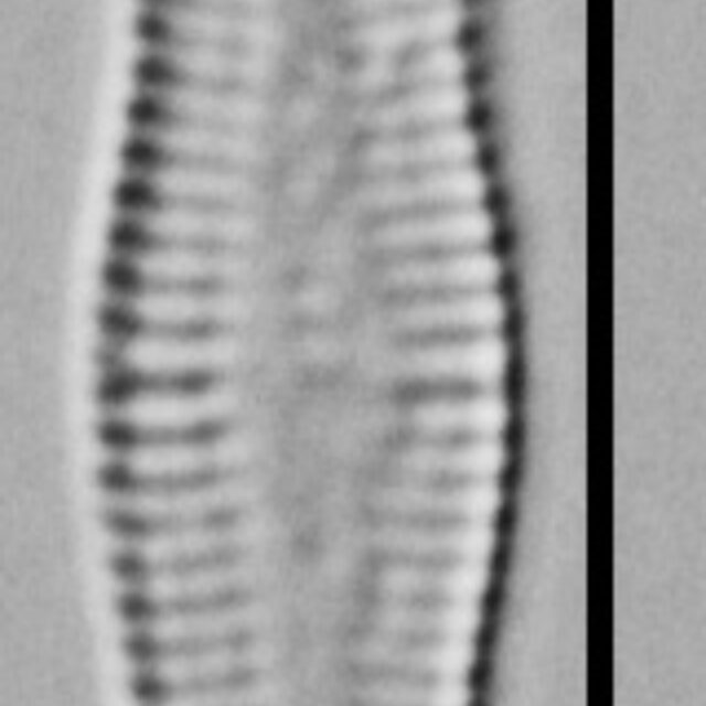 Achnanthidium Rosenstockii Vt10089 A 010418 05 C