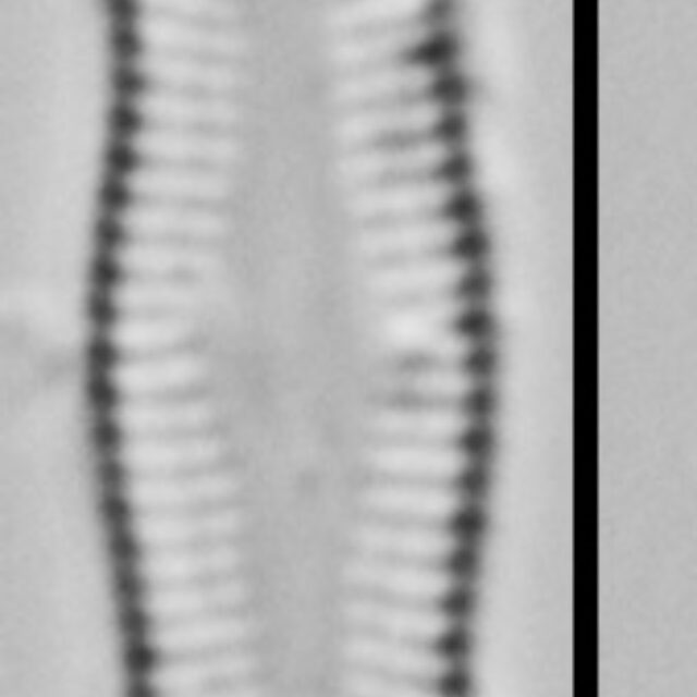 Achnanthidium Rosenstockii Vt10089 A 010418 07 C