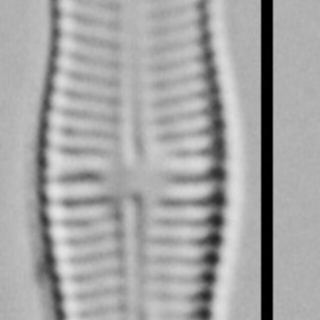 Achnanthidium Rosenstockii Vt10089 A 010418 11 C