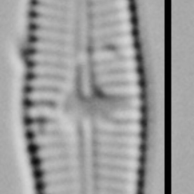 Achnanthidium Rosenstockii Vt10093 A 012618 02 C