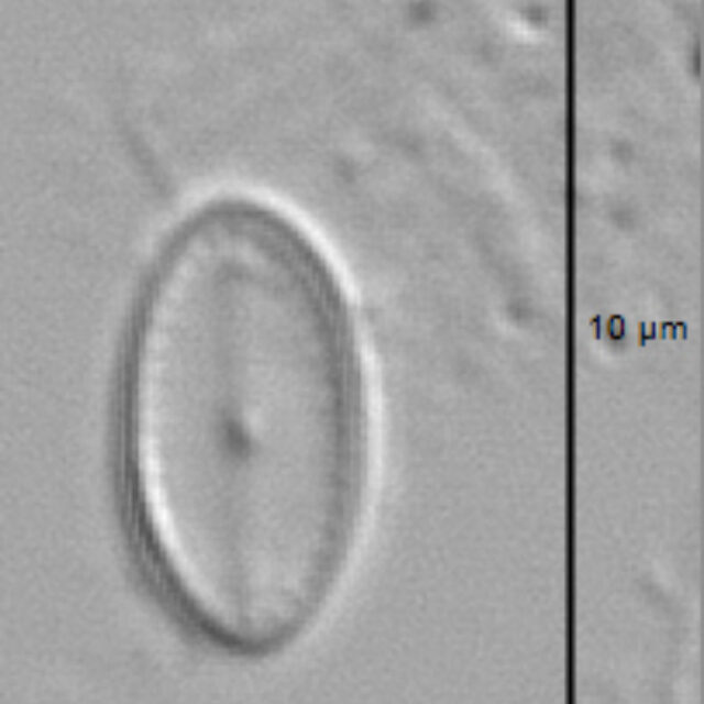 Amicula vermiculata LM2