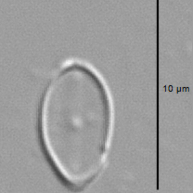 Amicula vermiculata LM3