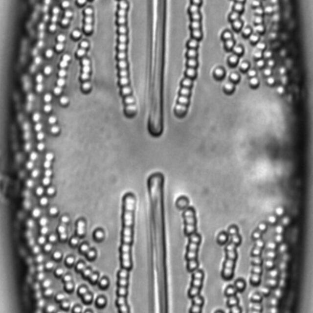 Anomoeoneis Costata LM3