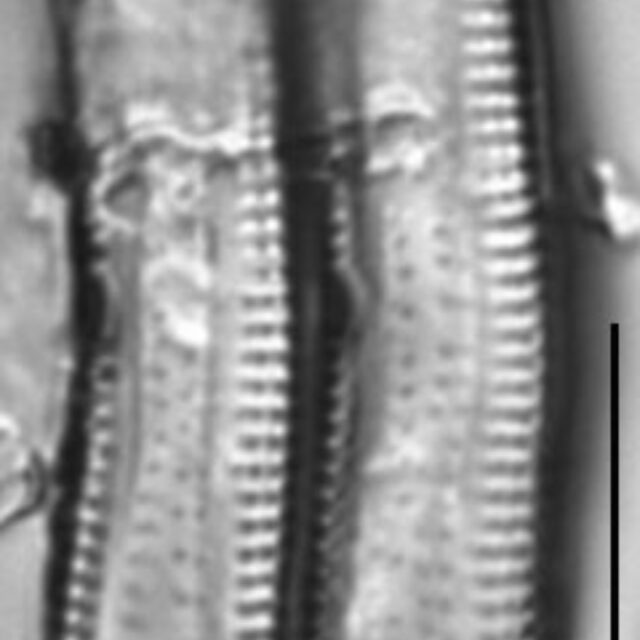 Achnanthes tumescens LM1