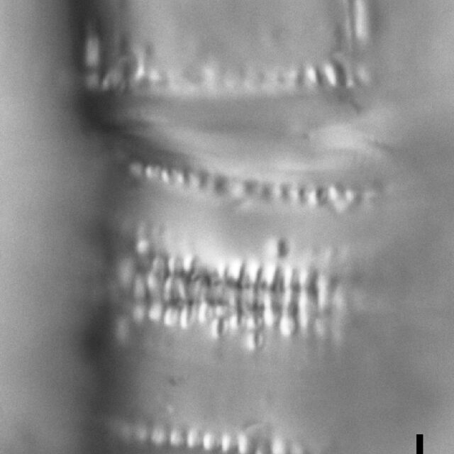 Aulacoseira newjerseyana LM5