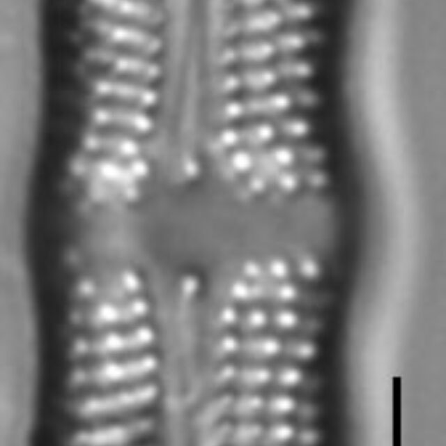 Achnanthes undulorostrata LM1