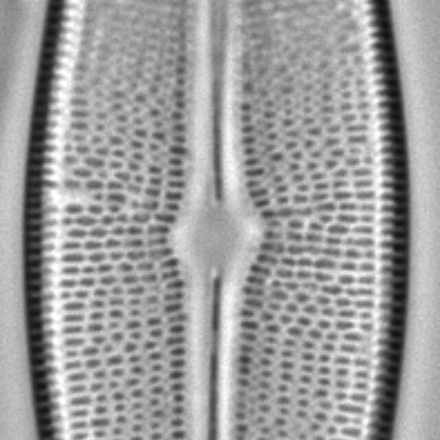 Brachysira serians LM3