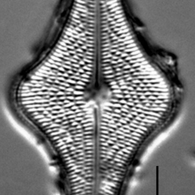 Brachysira follis LM6