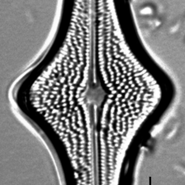 Brachysira follis LM2