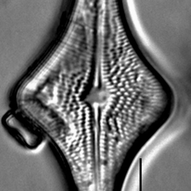 Brachysira follis LM4