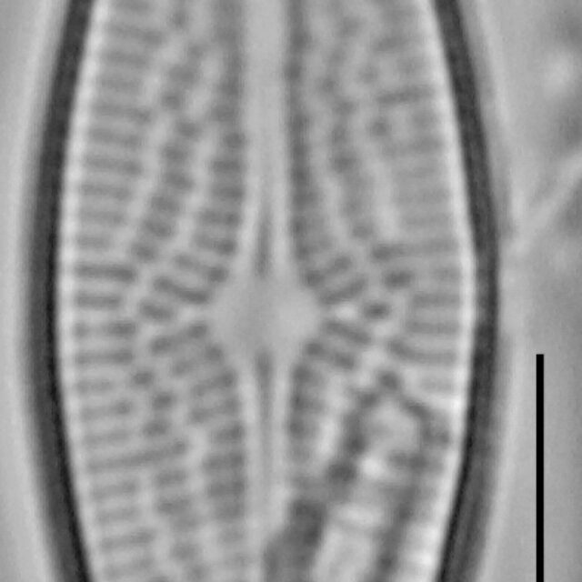 Brachysira brebissonii LM4