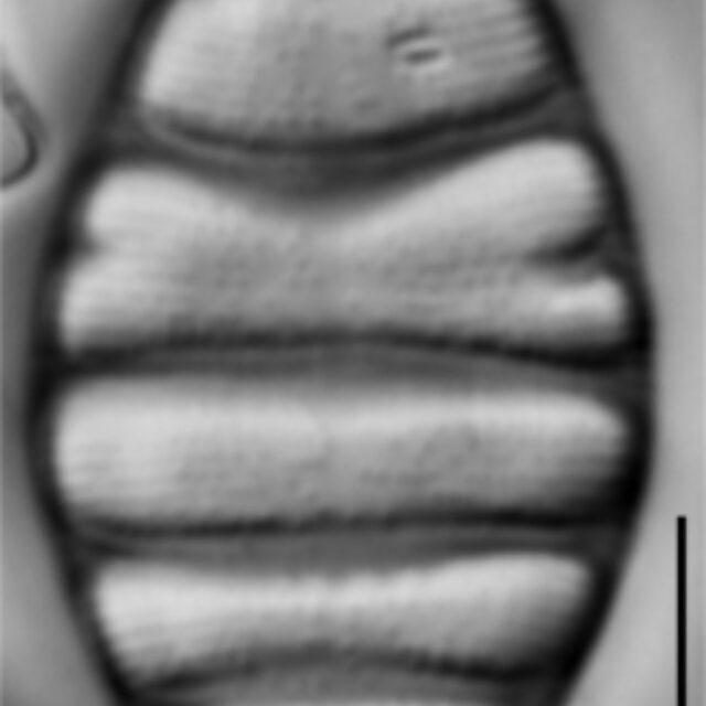 Tetracyclus hinziae LM7