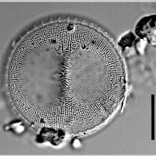 Ca 10035 06112018 21 Thalassiosira Gessneri Lm 01